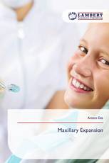 Maxillary Expansion