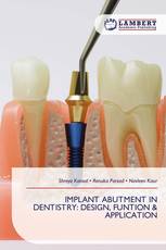 IMPLANT ABUTMENT IN DENTISTRY: DESIGN, FUNTION & APPLICATION