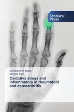 Oxidative stress and inflammatory in rheumatoid and osteoarthritis