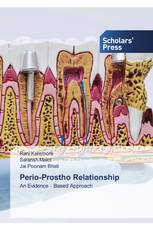 Perio-Prostho Relationship