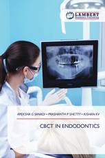 CBCT IN ENDODONTICS