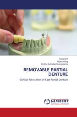 REMOVABLE PARTIAL DENTURE