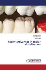 Recent Advances in molar distalization