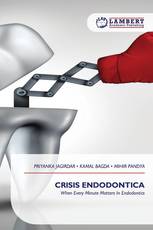 CRISIS ENDODONTICA
