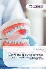 ADVANCES IN CARIES CONTROL