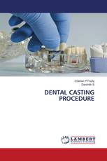 DENTAL CASTING PROCEDURE