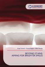 BEYOND STAINS: AIMING FOR BRIGHTER SMILES