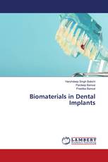 Biomaterials in Dental Implants