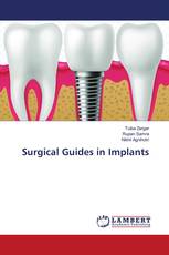 Surgical Guides in Implants
