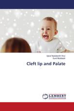 Cleft lip and Palate