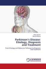 Parkinson’s Disease: Etiology, Diagnosis and Treatment