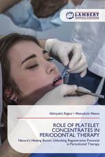 ROLE OF PLATELET CONCENTRATES IN PERIODONTAL THERAPY