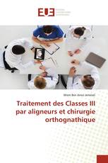 Traitement des Classes III par aligneurs et chirurgie orthognathique