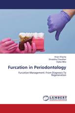 Furcation in Periodontology