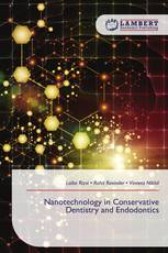Nanotechnology in Conservative Dentistry and Endodontics