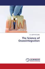 The Science of Osseointegration