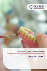 OVERDENTURES