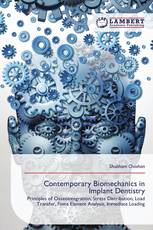 Contemporary Biomechanics in Implant Dentistry