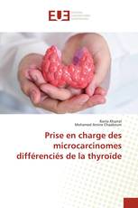 Prise en charge des microcarcinomes différenciés de la thyroïde