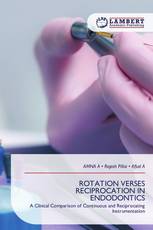ROTATION VERSES RECIPROCATION IN ENDODONTICS