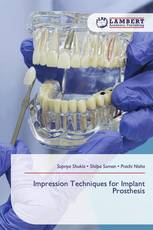 Impression Techniques for Implant Prosthesis