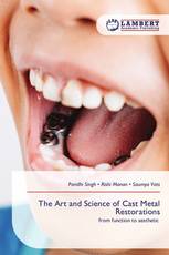 The Art and Science of Cast Metal Restorations