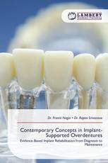 Contemporary Concepts in Implant-Supported Overdentures