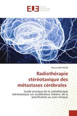 Radiothérapie stéréotaxique des métastases cérébrales