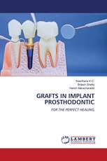 GRAFTS IN IMPLANT PROSTHODONTIC