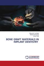 BONE GRAFT MATERIALS IN IMPLANT DENTISTRY