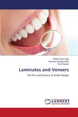 Laminates and Veneers