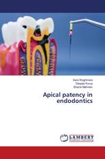 Apical patency in endodontics