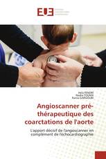 Angioscanner pré-thérapeutique des coarctations de l'aorte