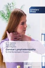 Cervical Lymphadenopathy