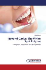 Beyond Caries: The White Spot Enigma