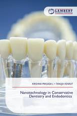 Nanotechnology in Conservative Dentistry and Endodontics