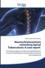 Neuroschistosomiasis mimicking Spinal Tuberculosis: A case report