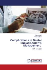 Complications In Dental Implant And It’s Management