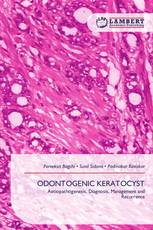 ODONTOGENIC KERATOCYST
