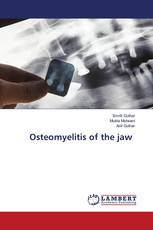 Osteomyelitis of the jaw