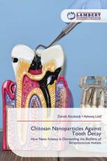 Chitosan Nanoparticles Against Tooth Decay