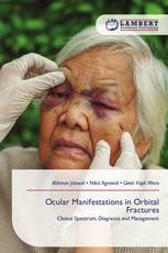 Ocular Manifestations in Orbital Fractures