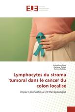 Lymphocytes du stroma tumoral dans le cancer du colon localisé
