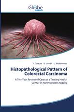 Histopathological Pattern of Colorectal Carcinoma