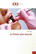 Le lichen plan buccal