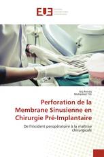 Perforation de la Membrane Sinusienne en Chirurgie Pré-Implantaire