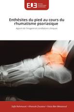 Enthésites du pied au cours du rhumatisme psoriasique