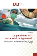 Le lymphome NK/T extranodal de type nasal