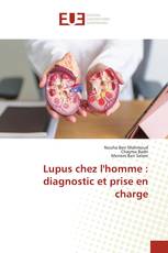 Lupus chez l'homme : diagnostic et prise en charge