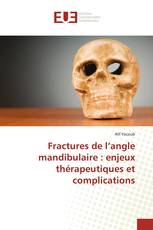 Fractures de l’angle mandibulaire : enjeux thérapeutiques et complications